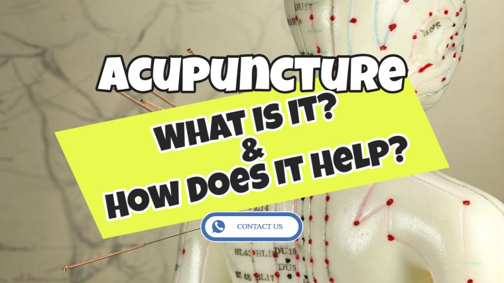 acupuncture - what is it